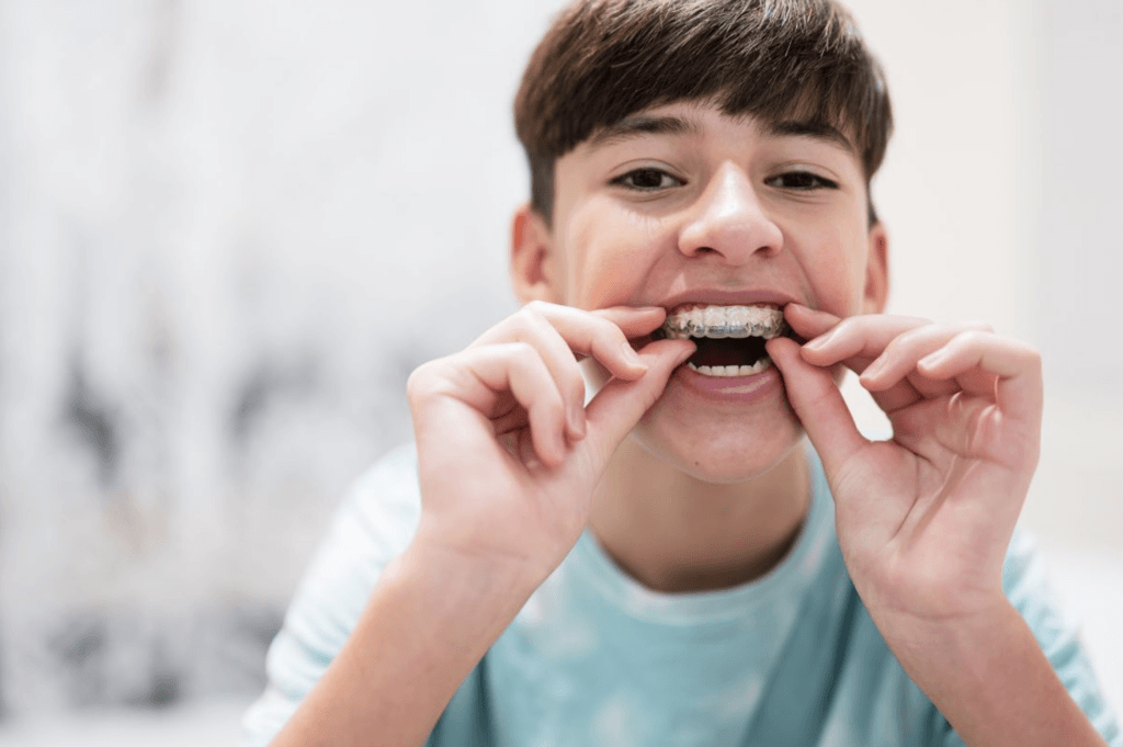 Invisalign voor kinderen